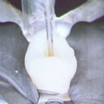 orascope
